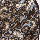 Anti-SLC13A3 antibody produced in rabbit Prestige Antibodies® Powered by Atlas Antibodies, affinity isolated antibody, buffered aqueous glycerol solution