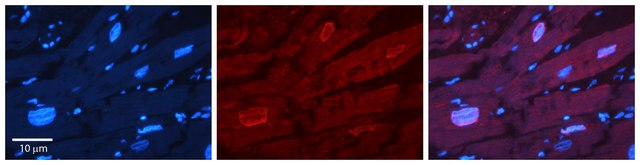 Anti-ERF, (N-terminal) antibody produced in rabbit affinity isolated antibody