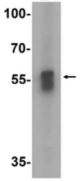 Anti-TFEB Antibody from rabbit, purified by affinity chromatography