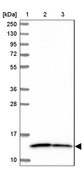 Anti-NDUFS5 antibody produced in rabbit Prestige Antibodies® Powered by Atlas Antibodies, affinity isolated antibody, buffered aqueous glycerol solution