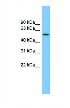 Anti-GLCCI1 antibody produced in rabbit affinity isolated antibody