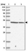 Anti-FBXL8 antibody produced in rabbit Prestige Antibodies® Powered by Atlas Antibodies, affinity isolated antibody, buffered aqueous glycerol solution