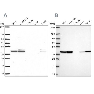 Anti-STRAP antibody produced in rabbit Prestige Antibodies&#174; Powered by Atlas Antibodies, affinity isolated antibody, buffered aqueous glycerol solution