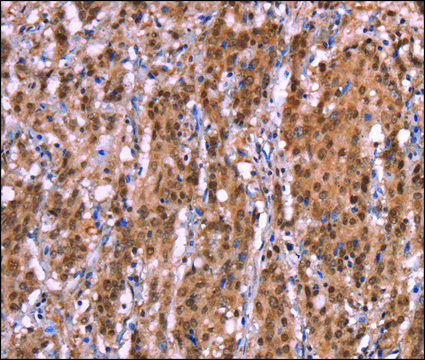 Anti-AMER1 antibody produced in rabbit affinity isolated antibody