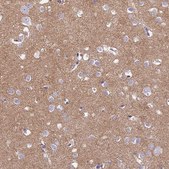 Anti-TMEM161B antibody produced in rabbit Prestige Antibodies® Powered by Atlas Antibodies, affinity isolated antibody, buffered aqueous glycerol solution