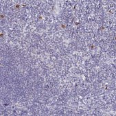 Anti-TNIP1 antibody produced in rabbit Prestige Antibodies® Powered by Atlas Antibodies, affinity isolated antibody, buffered aqueous glycerol solution