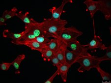 12Z Human Endometrial Epithelial Cell Line