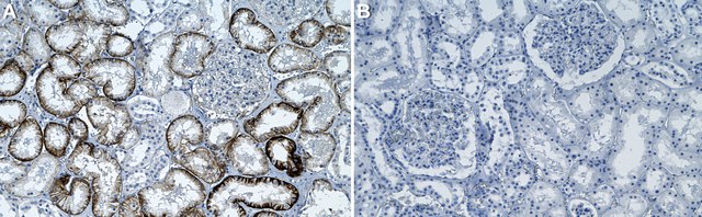 Anti-MCT8/SLC16A2 Antibody, clone 1I9 ZooMAb&#174; Rabbit Monoclonal recombinant, expressed in HEK 293 cells