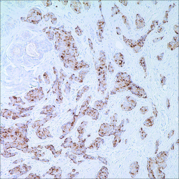 EMA (E29) Mouse Monoclonal Antibody