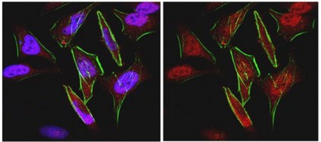 Anti-FOXC1 Antibody from rabbit, purified by affinity chromatography