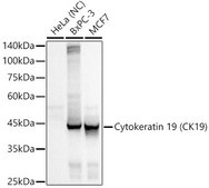 Anti-Cytokeratin 19 (KRT19) Antibody, clone 2Q5A5, Rabbit Monoclonal