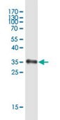 Monoclonal Anti-SPINK6 antibody produced n mouse clone 3C10, purified immunoglobulin, buffered aqueous solution