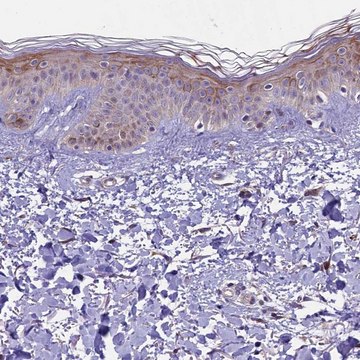 Anti-MIEF2 antibody produced in rabbit Prestige Antibodies&#174; Powered by Atlas Antibodies, affinity isolated antibody, buffered aqueous glycerol solution