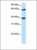 Anti-TKT antibody produced in rabbit affinity isolated antibody
