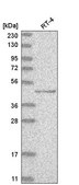 Anti-TP73 antibody produced in rabbit Prestige Antibodies® Powered by Atlas Antibodies, affinity isolated antibody