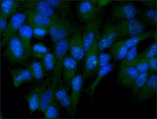 Anti-FKHRL1 (FOXO3a) antibody produced in rabbit affinity isolated antibody, buffered aqueous solution