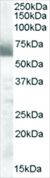 Anti-CYP17A1 antibody produced in goat affinity isolated antibody, buffered aqueous solution