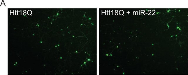 Anti-Huntingtin Antibody, a.a. 1-82 ascites fluid, clone 2B4, Chemicon&#174;