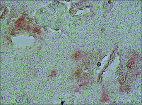 抗 &#945;-突触核蛋白 兔抗 IgG fraction of antiserum, buffered aqueous solution