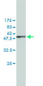 Monoclonal Anti-NME1 antibody produced in mouse clone 2H1, purified immunoglobulin, buffered aqueous solution