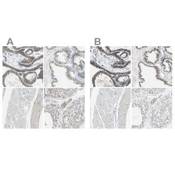 Anti-B4GALT1 antibody produced in rabbit Ab1, Prestige Antibodies&#174; Powered by Atlas Antibodies, affinity isolated antibody, buffered aqueous glycerol solution