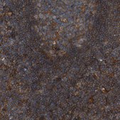 Anti-SAMD9L antibody produced in rabbit Prestige Antibodies® Powered by Atlas Antibodies, affinity isolated antibody, buffered aqueous glycerol solution, Ab2