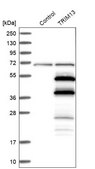 Anti-TRIM13 antibody produced in rabbit Prestige Antibodies® Powered by Atlas Antibodies, affinity isolated antibody, buffered aqueous glycerol solution