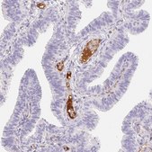 Anti-ITIH2 antibody produced in rabbit Prestige Antibodies® Powered by Atlas Antibodies, affinity isolated antibody, buffered aqueous glycerol solution