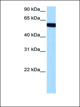 Anti-HCG_1646157 (AB2) antibody produced in rabbit affinity isolated antibody