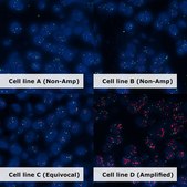 HER2 Analyte ControlDR Cell line controls for immunohistochemistry and in situ hybridization