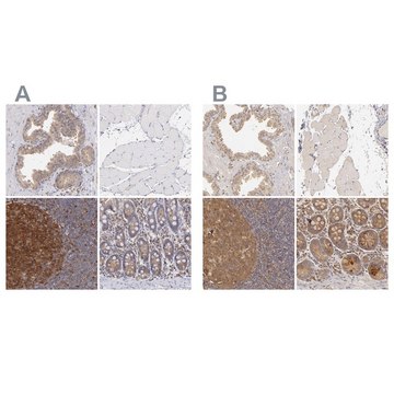 Anti-PRKCD antibody produced in rabbit Ab2, Prestige Antibodies&#174; Powered by Atlas Antibodies, affinity isolated antibody, buffered aqueous glycerol solution