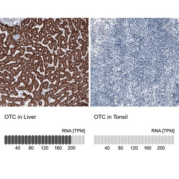 Monoclonal Anti-OTC antibody produced in mouse Prestige Antibodies&#174; Powered by Atlas Antibodies, clone CL4045, purified immunoglobulin