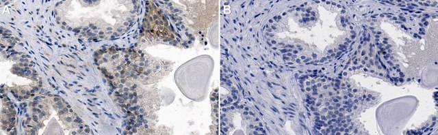 Anti-ELOVL5 Antibody, clone Z88