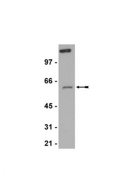 Anti-RIAP-3 (XIAP) Antibody Upstate&#174;, from rabbit