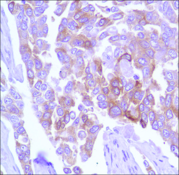 Anti-TAU antibody, Rabbit monoclonal clone SP70, recombinant, expressed in proprietary host, affinity isolated antibody