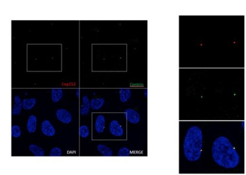 Anti-Cep152 (P7) from rabbit, purified by affinity chromatography