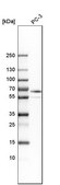 Anti-ABLIM3 antibody produced in rabbit Prestige Antibodies® Powered by Atlas Antibodies, affinity isolated antibody, buffered aqueous glycerol solution