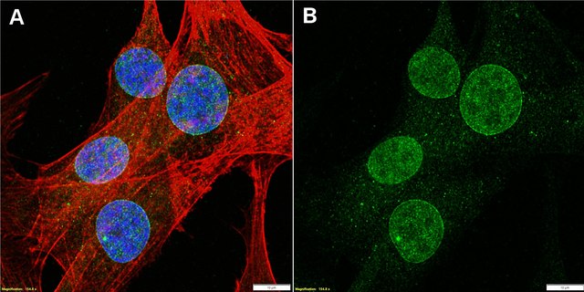 Anti-Nesprin-2/SYNE2