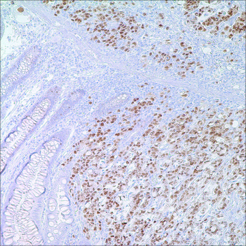 p53 (DO7) Mouse Monoclonal Antibody