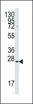 ANTI-GREMLIN (C-TERM) antibody produced in rabbit IgG fraction of antiserum, buffered aqueous solution