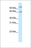 Anti-NET1 (ab1) antibody produced in rabbit affinity isolated antibody