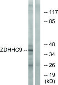 Anti-ZDHHC9 antibody produced in rabbit affinity isolated antibody
