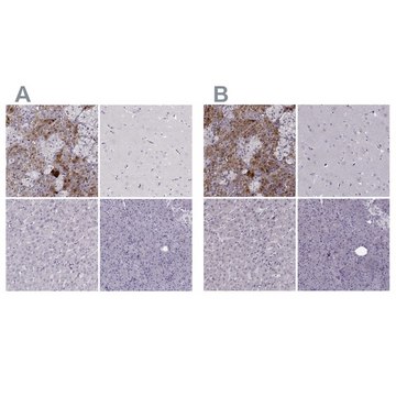 Anti-PNMT antibody produced in rabbit Prestige Antibodies&#174; Powered by Atlas Antibodies, affinity isolated antibody, buffered aqueous glycerol solution