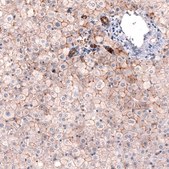 Monoclonal Anti-CLDN1 antibody produced in mouse Prestige Antibodies® Powered by Atlas Antibodies, clone CL3698, purified immunoglobulin, buffered aqueous glycerol solution