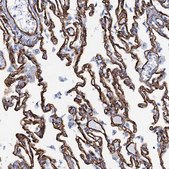 Anti-SDPR antibody produced in rabbit Prestige Antibodies® Powered by Atlas Antibodies, affinity isolated antibody, buffered aqueous glycerol solution