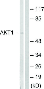 Anti-AKT antibody produced in rabbit affinity isolated antibody