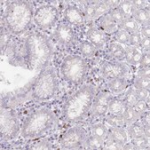 Anti-TMEM251 antibody produced in rabbit Prestige Antibodies® Powered by Atlas Antibodies, affinity isolated antibody, buffered aqueous glycerol solution