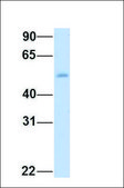 Anti-SLC2A8 antibody produced in rabbit affinity isolated antibody