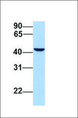 Anti-ACTR1B antibody produced in rabbit affinity isolated antibody