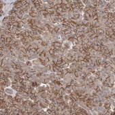 Anti-NRCAM antibody produced in rabbit Prestige Antibodies® Powered by Atlas Antibodies, affinity isolated antibody, buffered aqueous glycerol solution